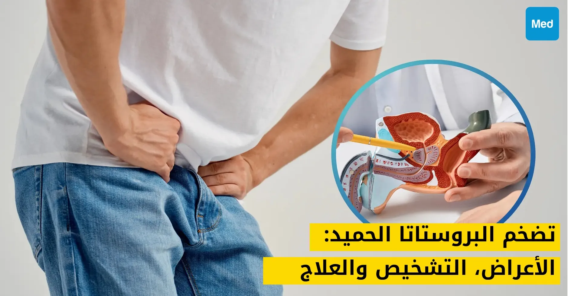 تضخم البروستاتا الحميد: الأعراض، التشخيص والعلاج